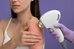 🔥 سوختگی بعد از لیزر؛ علت‌ها، پیشگیری و راهکارهای حرفه‌ای